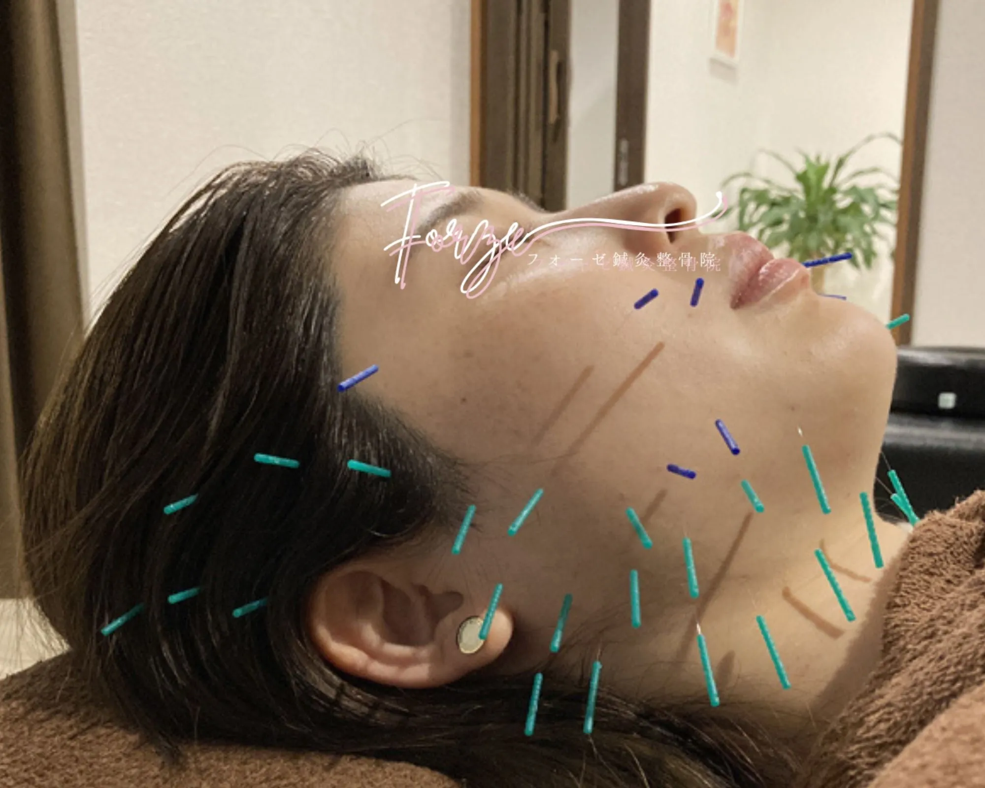 forzeharikyuusekotsuin – ラウンジバイト フォーゼ鍼灸整骨院ブログ内画像